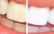 Eagle Heights Dental Care - thumb 1