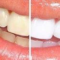 Eagle Heights Dental Care - Dentists Newcastle 1
