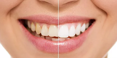 Newcastle Dental Care - Dentists Newcastle 3