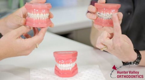 Hunter Valley Orthodontics - Dentists Newcastle 7
