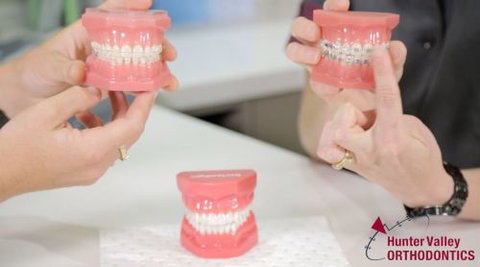 Hunter Valley Orthodontics - Dentists Newcastle 79