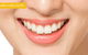 All Smiles Dental - thumb 1