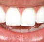 Bendigo Dentist On Hargreaves - Dentists Newcastle