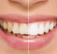 All About Smiles Ettalong - Dentists Newcastle
