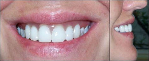 Active Denture Clinic - Dentists Newcastle 1