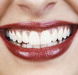 Rosenthal Dental Surgery - Dentists Newcastle
