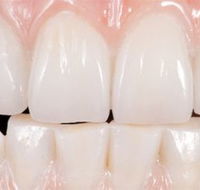 Dentiform Australia Pty Ltd - Dentists Newcastle