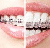 The White Bite - Dentists Newcastle