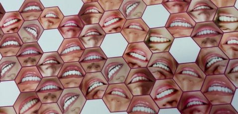 D&M Denture Clinic - Dentists Newcastle 8