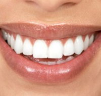 Smile Professionals - Reliable Cosmetic Dentistry in Perth - Dentists Newcastle