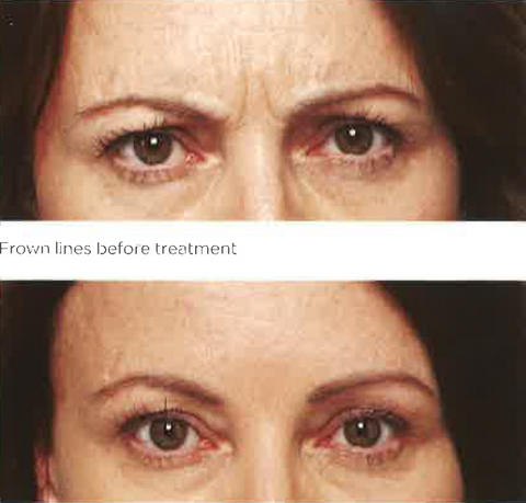 Bay Cosmetic Centre - Dentists Newcastle 2