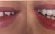 Dr Amanda J. Yu - thumb 4