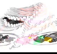 Dannalees Mobile Denture Service - Dentists Newcastle