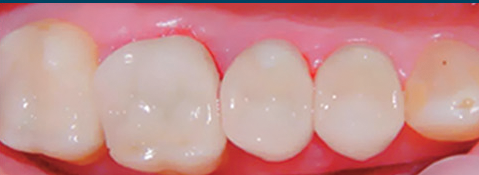 Sundial Dental - Dentists Newcastle 5