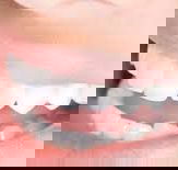 Ramana HarryDental Prosthetist - Dentists Newcastle