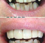 Your Dentist Gunnedah - Dentists Newcastle