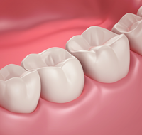 Coastal Dental Implants - Dentists Newcastle
