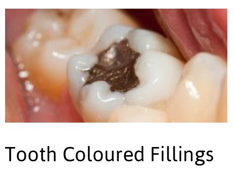 A2Z Dental - Dentists Newcastle 3