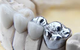 Hervey Bay Dental - thumb 5