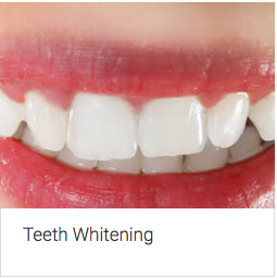 Aura Dental Centre - Dentists Newcastle 5