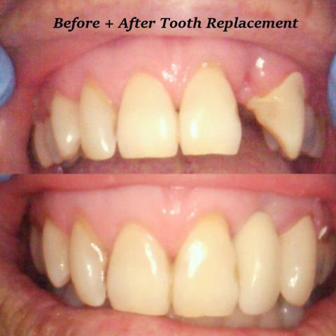 Fraser Shores Family Dental - Dentists Newcastle 3