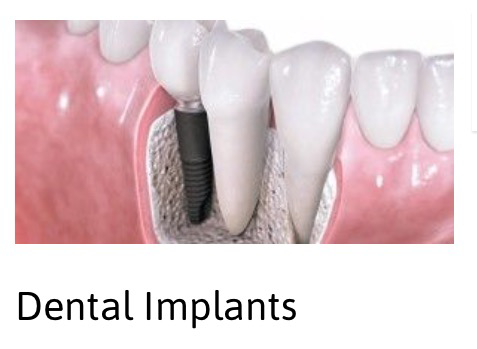 A2Z Dental - Dentists Newcastle 9